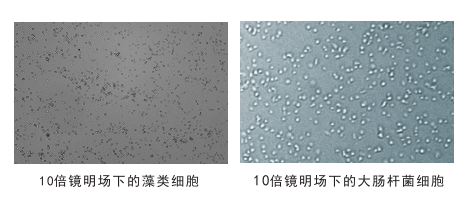 細(xì)胞計(jì)數(shù)儀鏡頭下的細(xì)胞圖片 細(xì)胞計(jì)數(shù)儀鏡頭下的細(xì)胞圖片